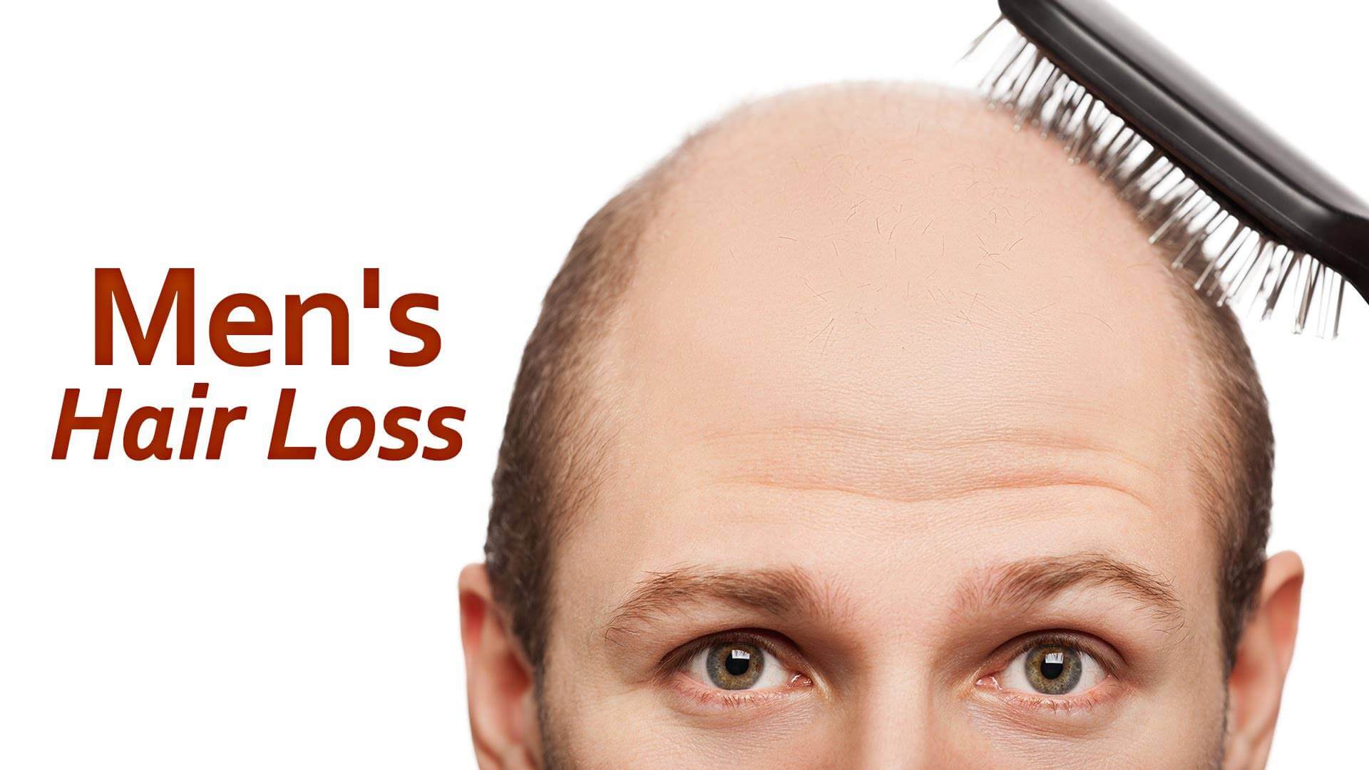 What’s the Best Fix for Male Hair Loss?